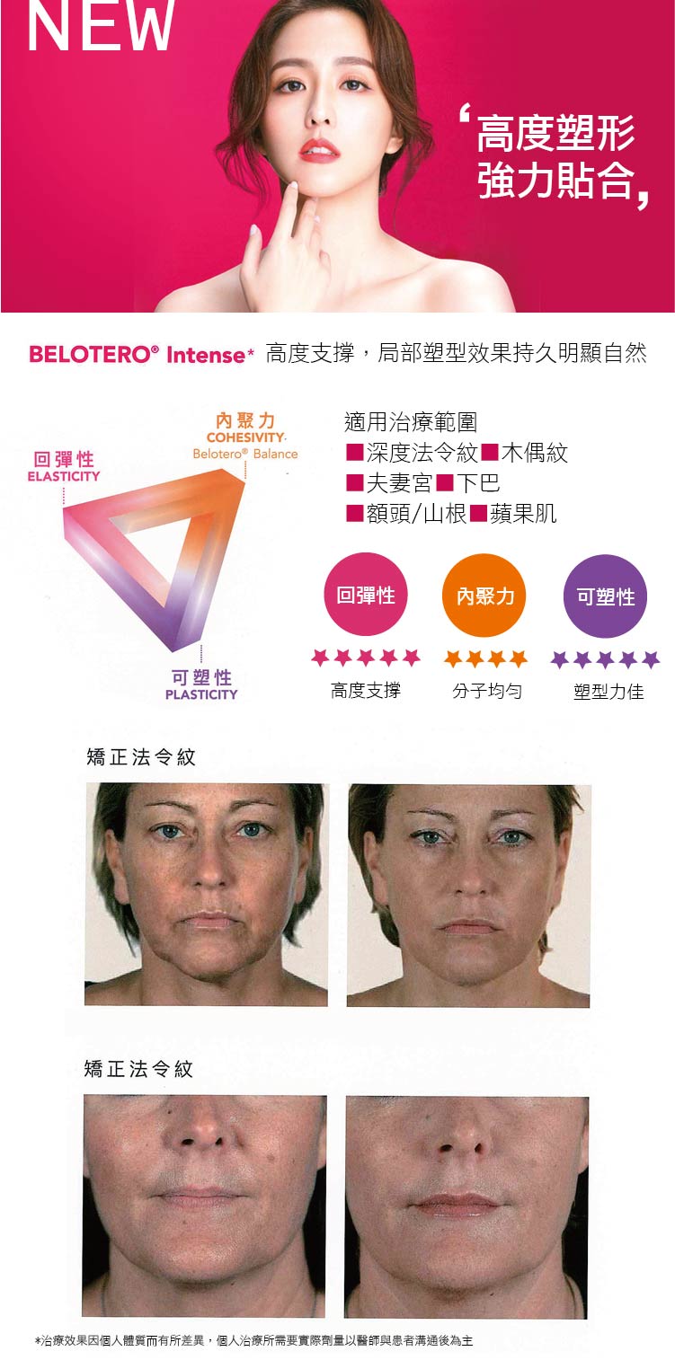 水無痕玻尿酸, Belotero