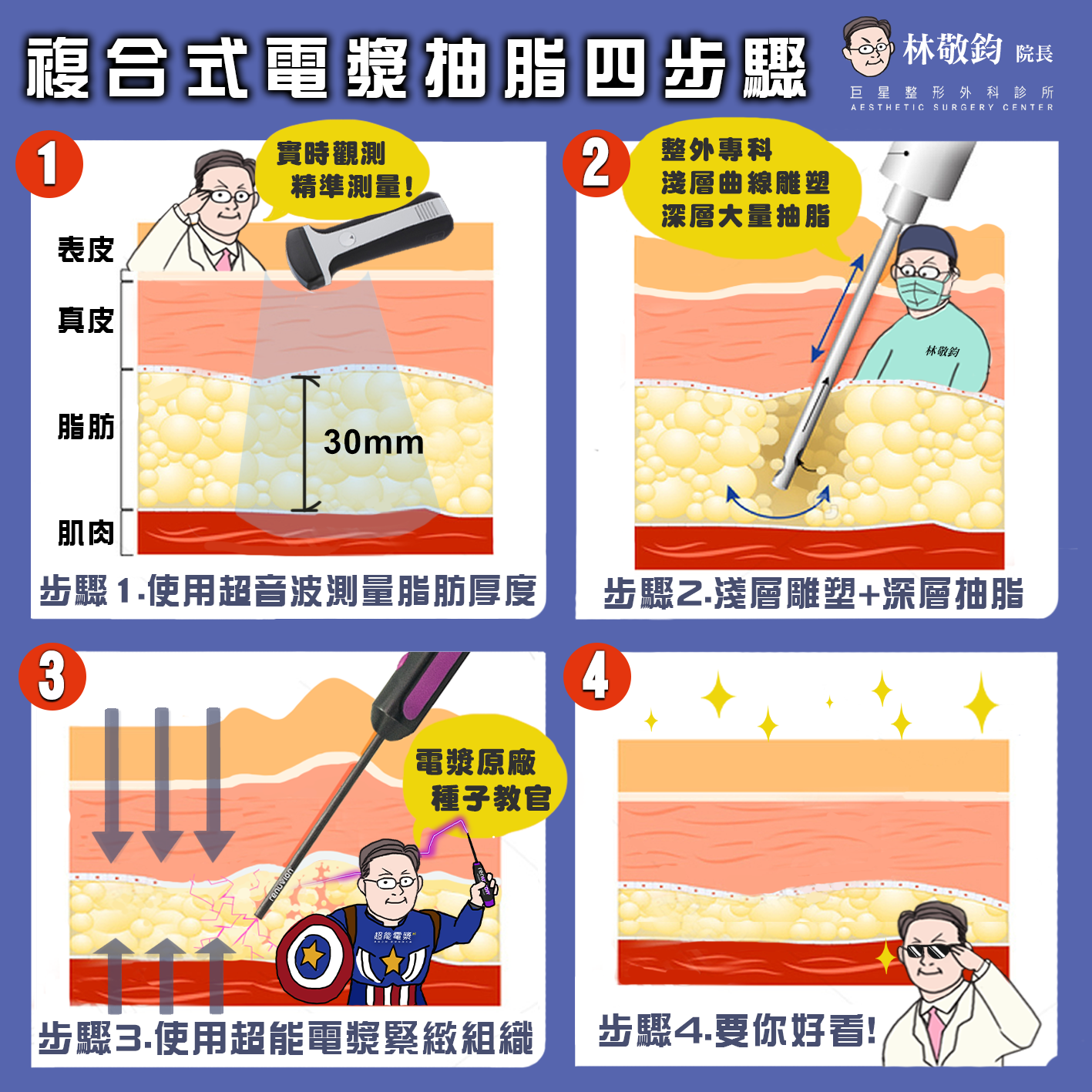 電漿抽脂,超能電漿 電漿抽脂,超能電漿